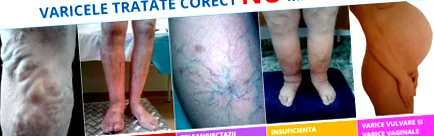 винче специјалист