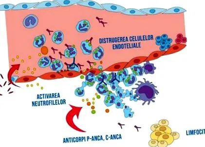 avacopan
