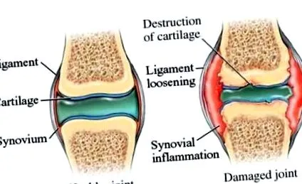 kutyák osteoarthritisének