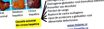 pečene gastroenterologická