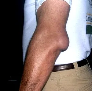 általános állapota