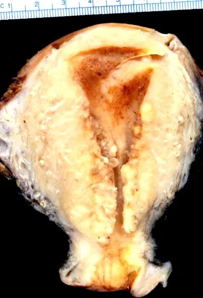 ciszta