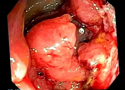 sigmoid