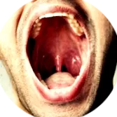 torokrák