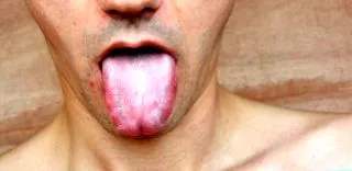 candida