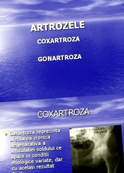 csípőízület