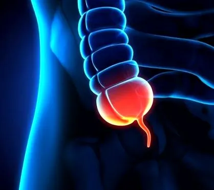 appendectomy