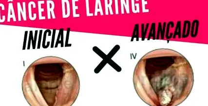 gége