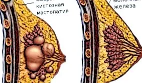 млечната млечната