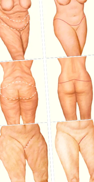 vagy