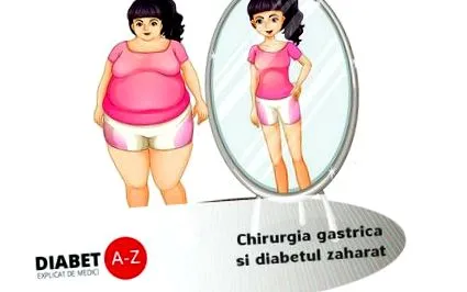 гастрична баријатриска