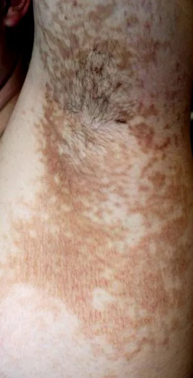 конфлуентна