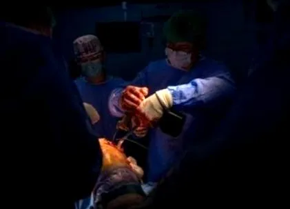 csípőízület osteoarthritisének