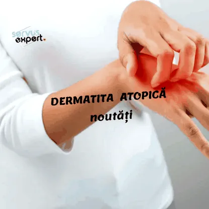 atópiás dermatitis