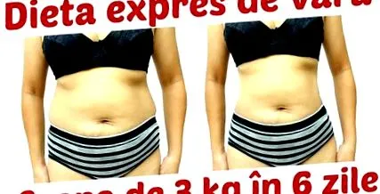expressz