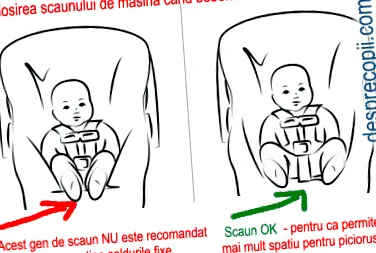 diszplázia