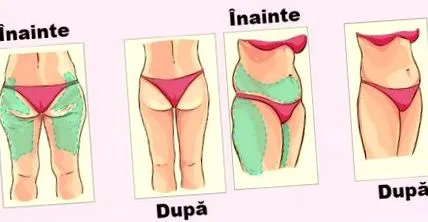 diéták