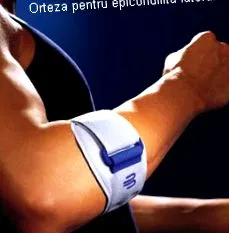 epicondylitis