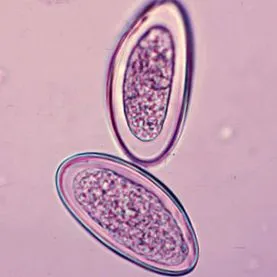 enterobius