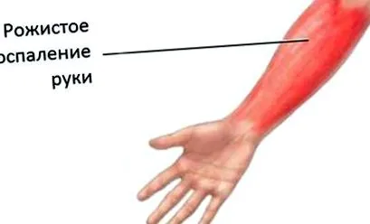 засобами