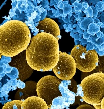staphylococcus