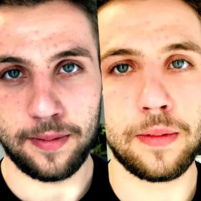 ásványi anyagok méregtelenítés