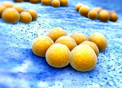 aureus