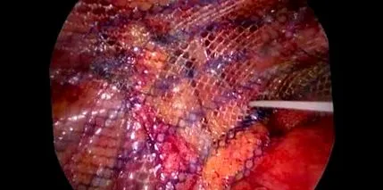 појавува појавува