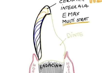 furnérok fogászati