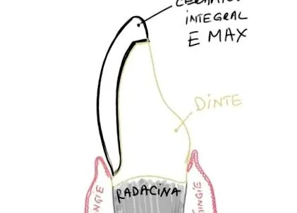 mennyibe fogászati