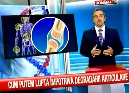 ízületi ízületi