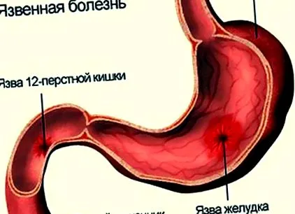 amelynek amelynek