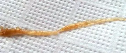 worm worm
