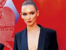 Вуха, як у слона! пластичний хірург назвав наречену Федора Бондарчука найкрасивішою жінкою пластичний