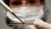 Вірус імунодефіциту у котів та котів симптоми та лікування вірус