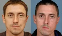 127872 Сонник Параліч, до чого сниться Параліч жінці, що означає побачити Параліч уві сні 127872