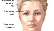 127872 Сонник Параліч, до чого сниться Параліч жінці, що означає побачити Параліч уві сні сонник
