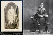 9 Людей, які мають зайві частини тіла (Фото) зайві
