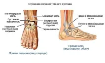 Артроз гомілковостопа - лікування гомілковостопного суглоба, Лікування суглобів гомілковостопа
