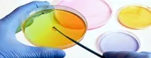 Бактеріологічне дослідження сечі – на що звернути увагу звернути