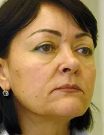 Безопераційний ліфтинг з армуванням тканин Аптос ліфтинг