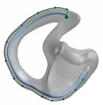 Технологія - Innovation Ear Design innovation