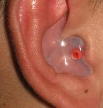 Технологія - Innovation Ear Design design
