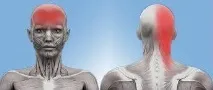 ЦЕРВІКОГЕННИЙ ГОЛОВНИЙ БІЛЬ головний