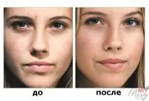 чищення