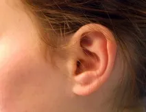 Що таке отит, симптоми та лікування хвороби отит остиопатією отит