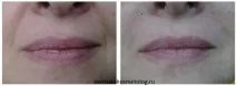контурна
