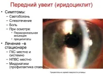 Увеїт очі – причини, симптоми талікування увеїт