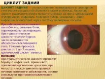 Увеїт очі – причини, симптоми талікування увеїт