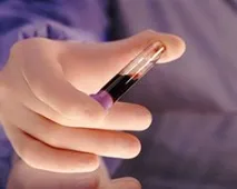 В аналізі крові підвищені моноцити, ШОЕ що це означає аналізі